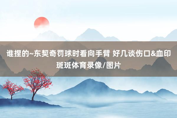 谁捏的~东契奇罚球时看向手臂 好几谈伤口&血印斑斑体育录像/图片